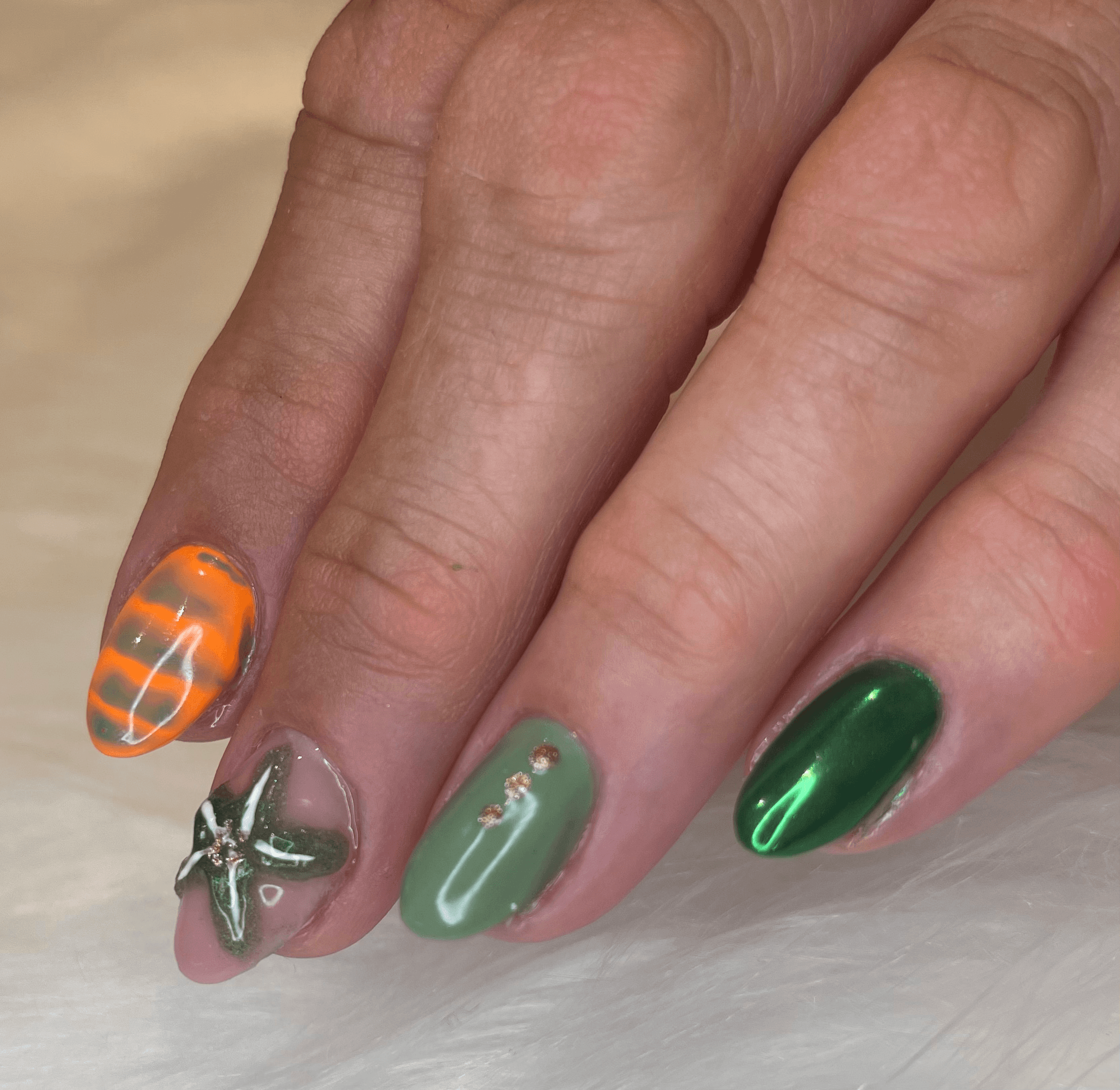 Remplissage gel 3D - Réalisation prothésiste ongulaire Laon